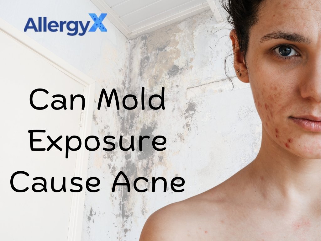 Can Mold Exposure Cause Acne? The Science Behind It & How to Protect Your Skin